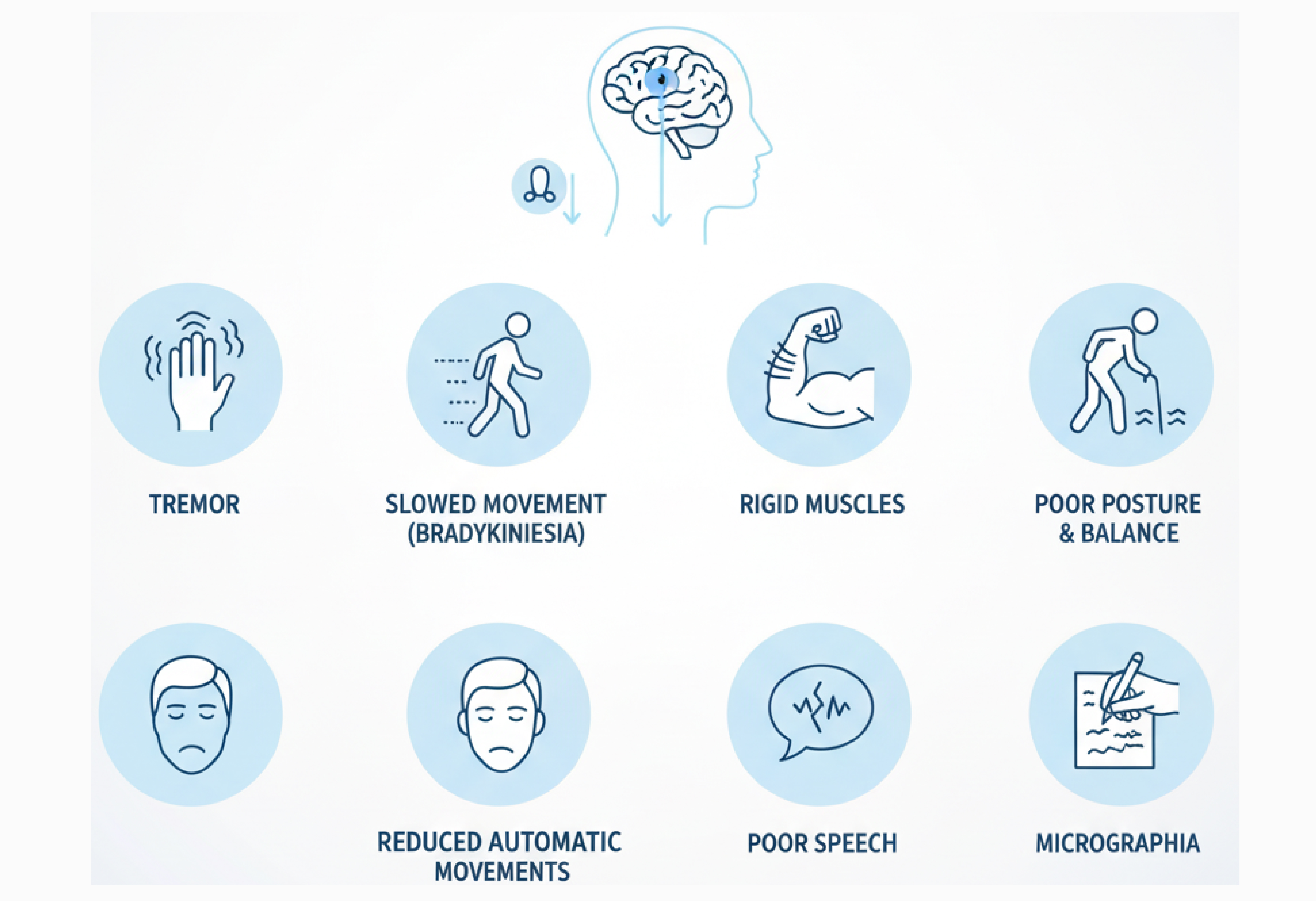 Parkinson’s Symptoms